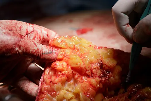 Hotellobby mit grüner Wand